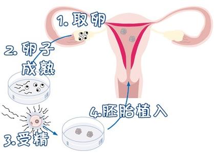 PGT胚胎实验室
